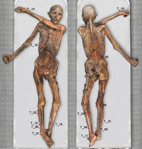 I tatuaggi della mummia Ötzi